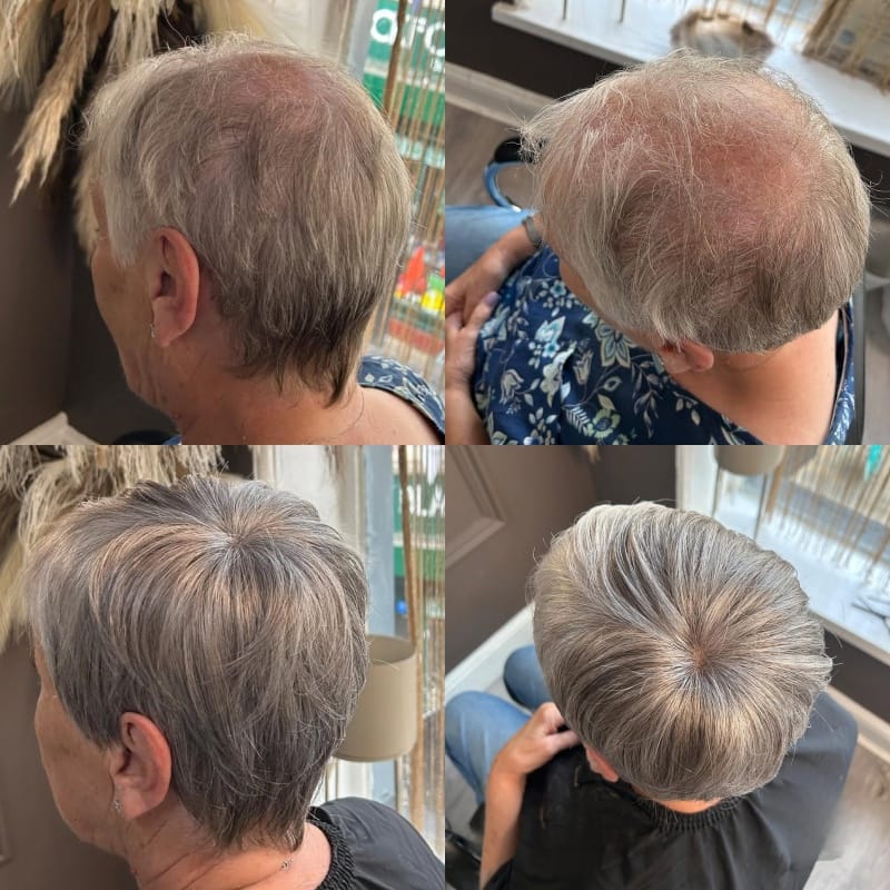 Customer photo review of 2025 Hot Sale Breathable & Natural Short Hair Topper For Women With Thinning Hair