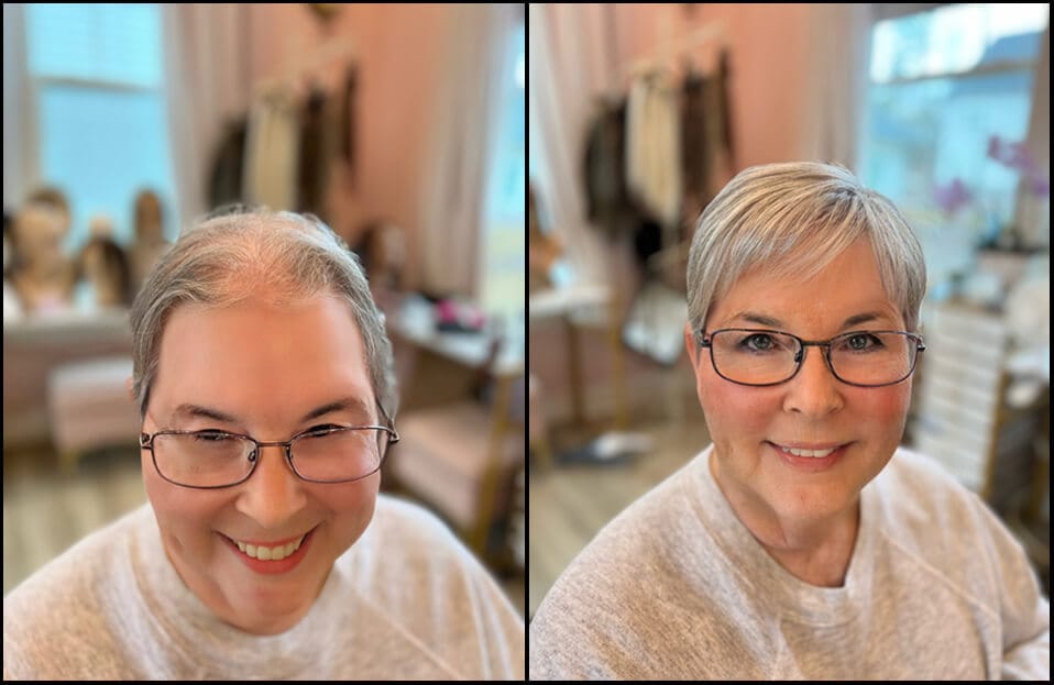 Customer photo review of High-Quality Short Hair Topper For Women With Thinning Hair