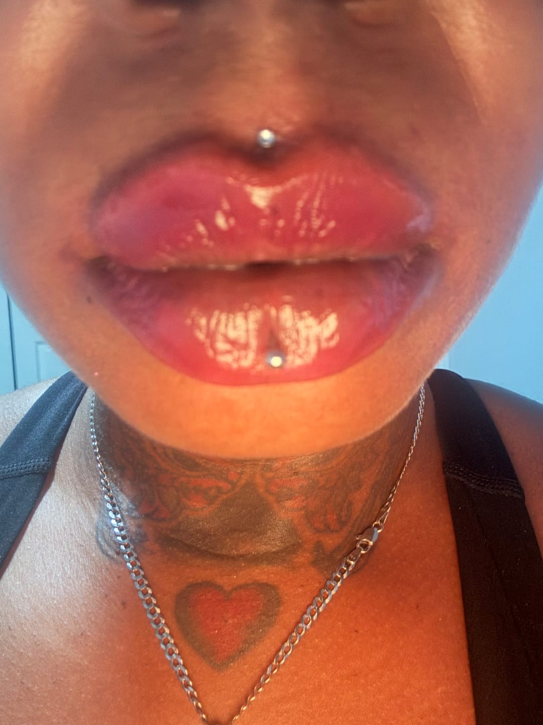 Customer photo review of Plumping Lip filler