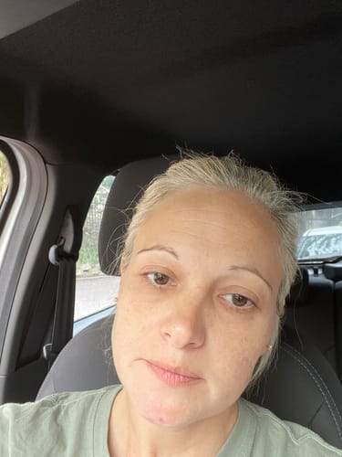 Customer photo review of The Glo Radiance Eye Cream