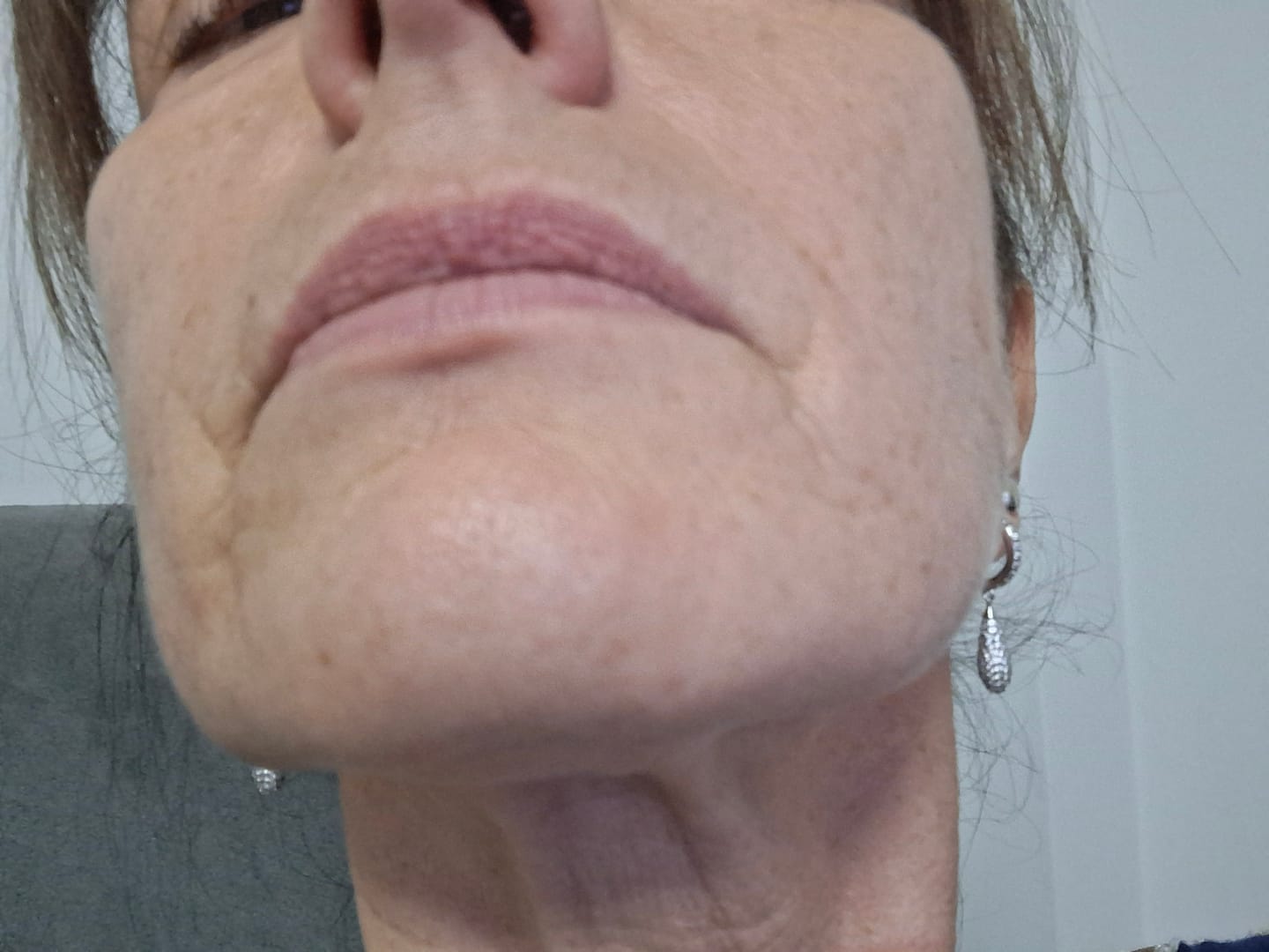 Customer photo review of Il trattamento notte Rose Therapy