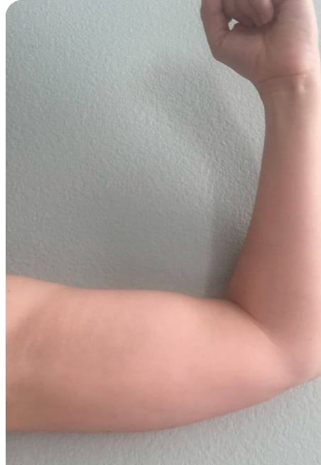 Customer photo review of Lifting Body Oil - Elixir Intense FontanaySkin™
