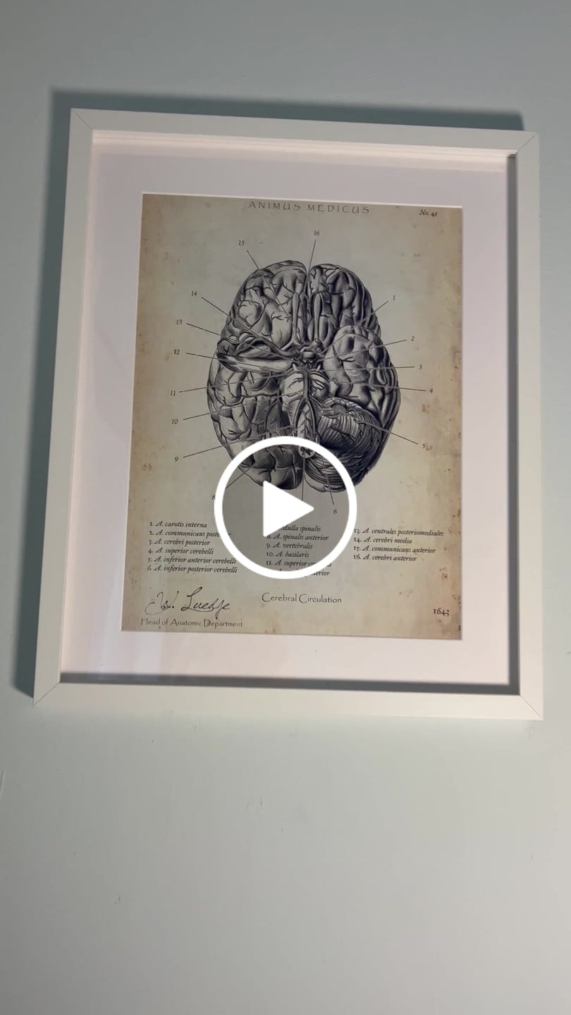 Customer video review of Circulus arteriosus willisii