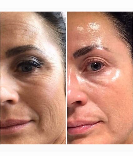 Customer photo review of LUMORA™ Copper Peptide Serum