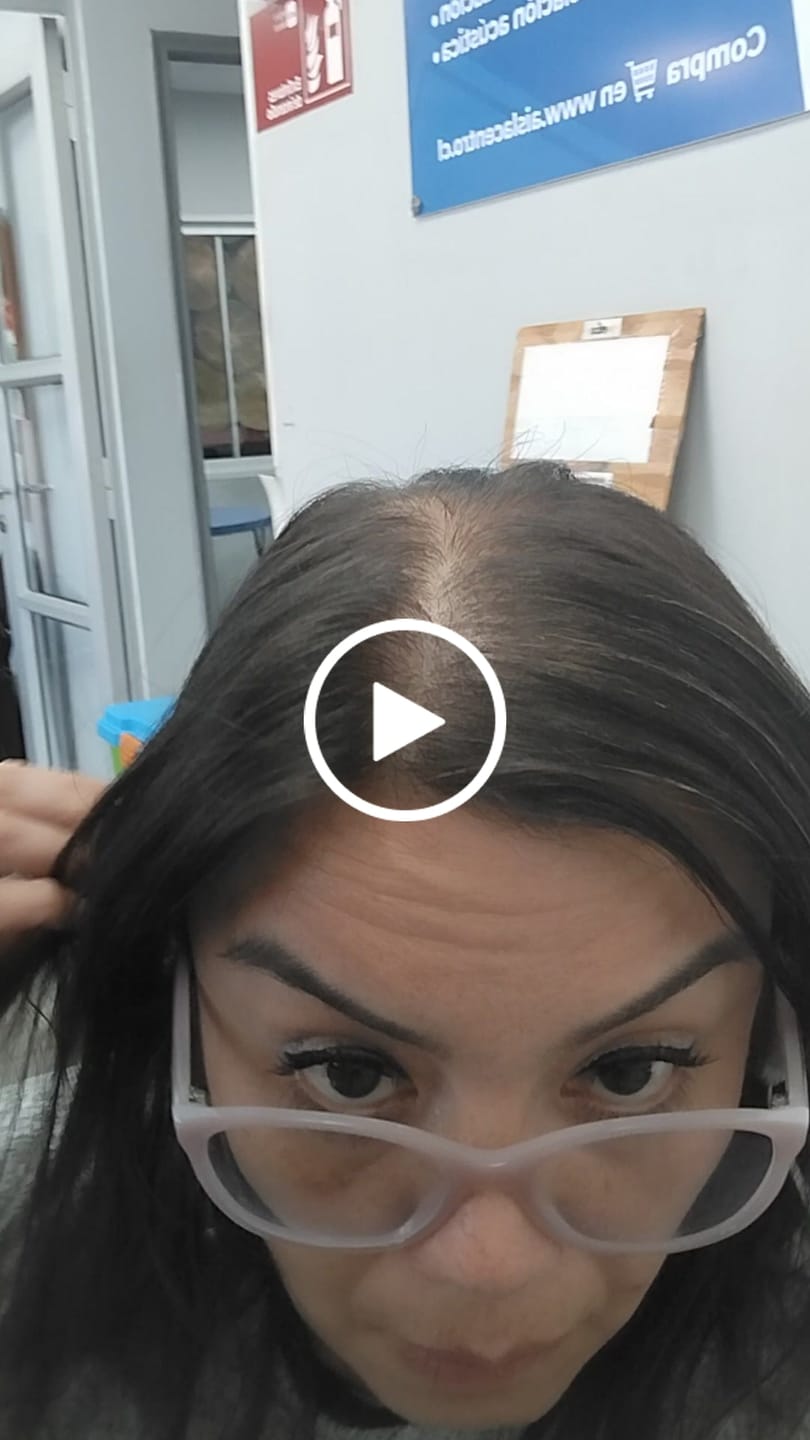Customer video review of DUO ANTIcaída CRECIMIENTO INTENSIVO Bomba + Tónico