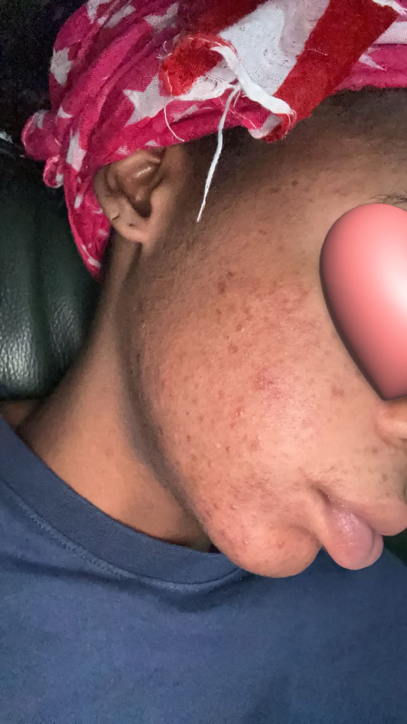 Customer photo review of KIT ViSAGE BISCUIT