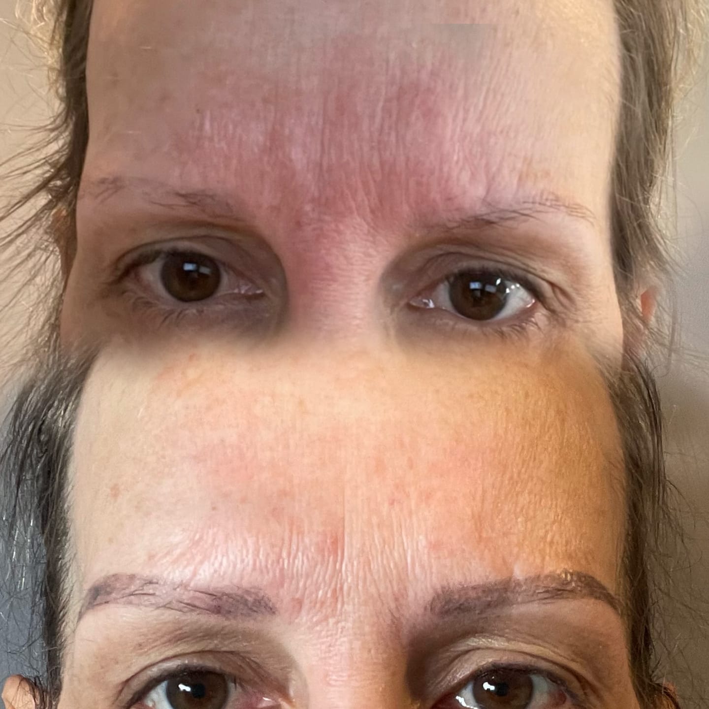 Customer photo review of LED Face Mask (Skin Photon Therapy)