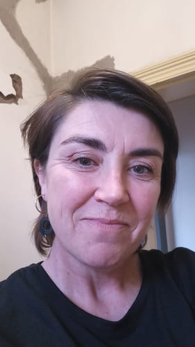 Customer photo review of The Glo Radiance Eye Cream