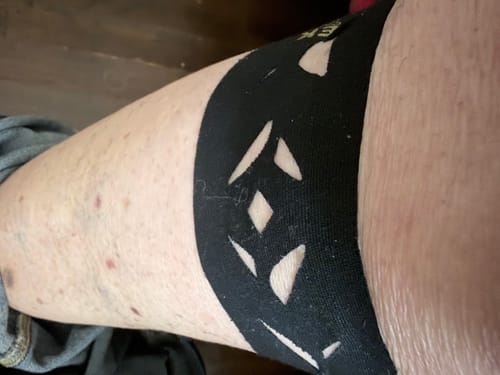 Customer photo review of Easy Kinesiology Tape (30-Day Supply)