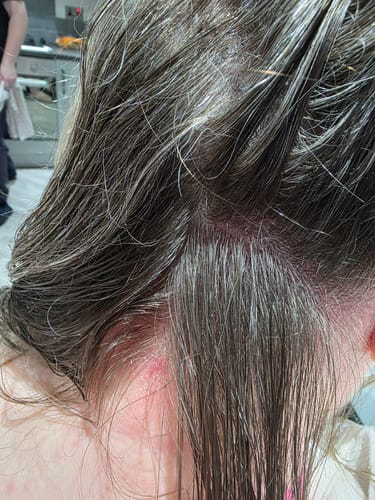 Customer photo review of Seb Natural Calming Serum