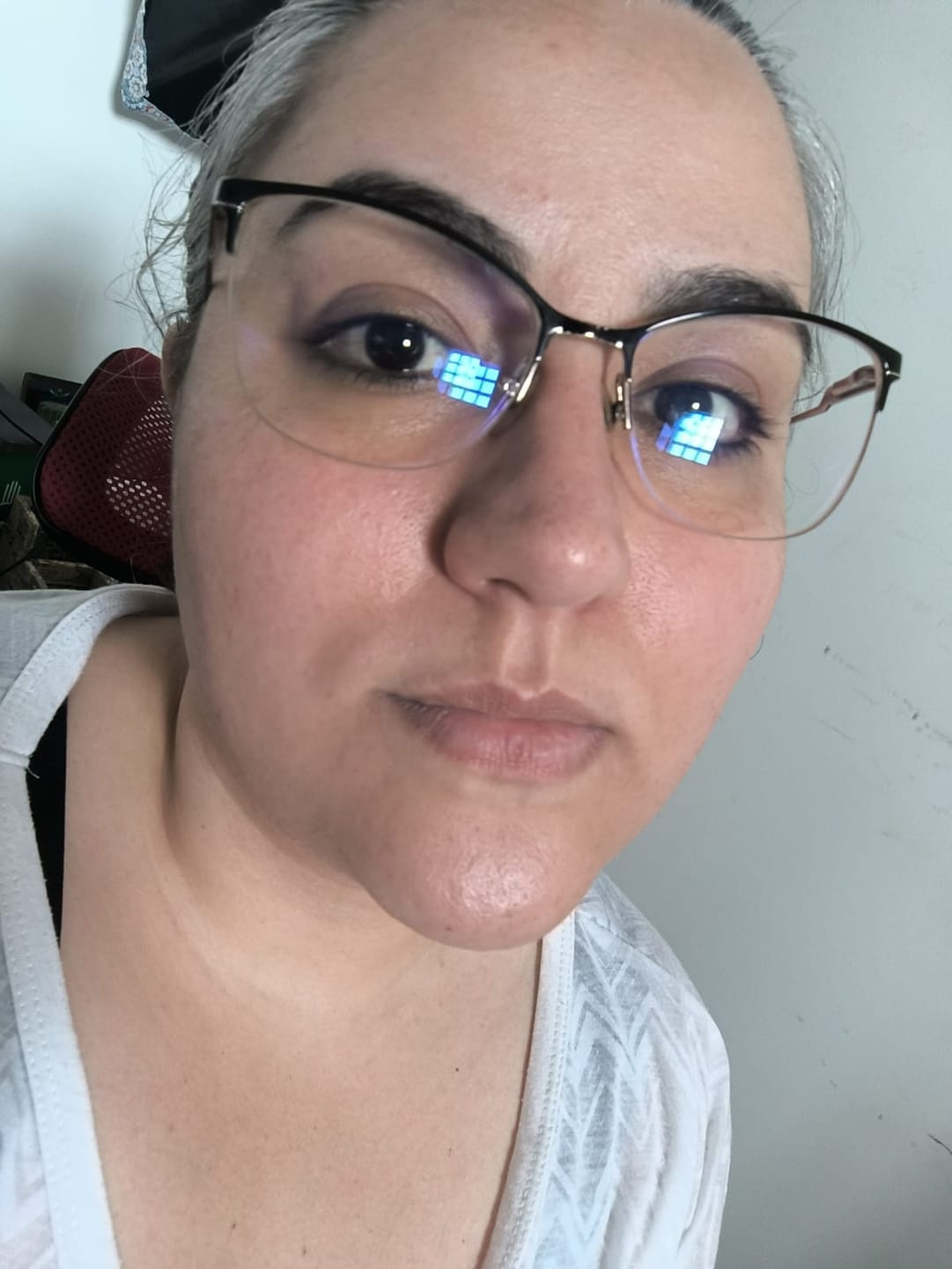 Customer photo review of Solução Niacinamida - Amostra Grátis