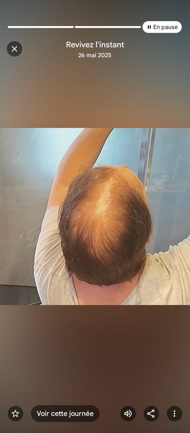 Customer photo review of La potion magique - Hair transformation