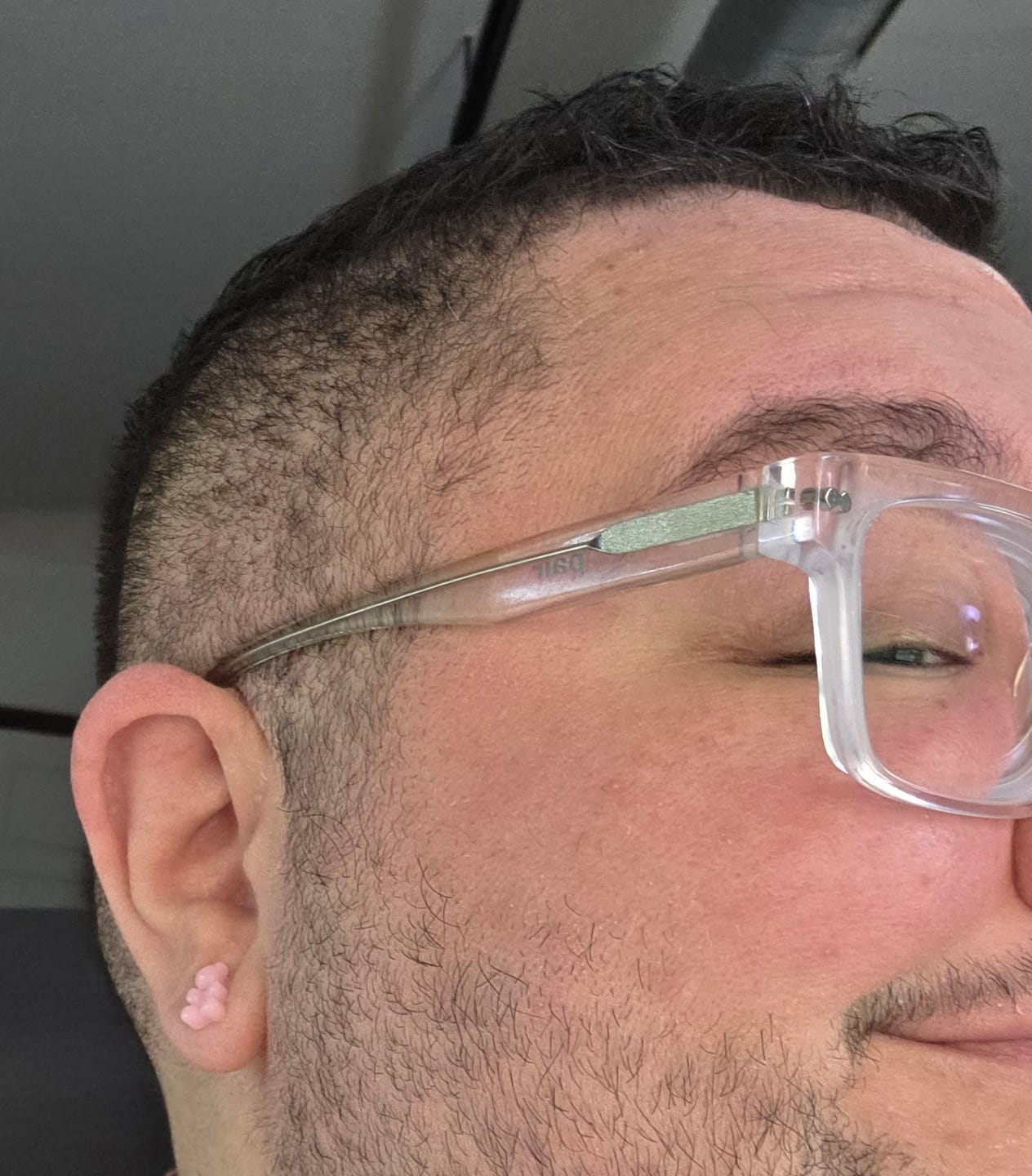 Customer photo review of Gummy Bear Studs Hypoallergenic Earrings for Sensitive Ears Made with Plastic Posts