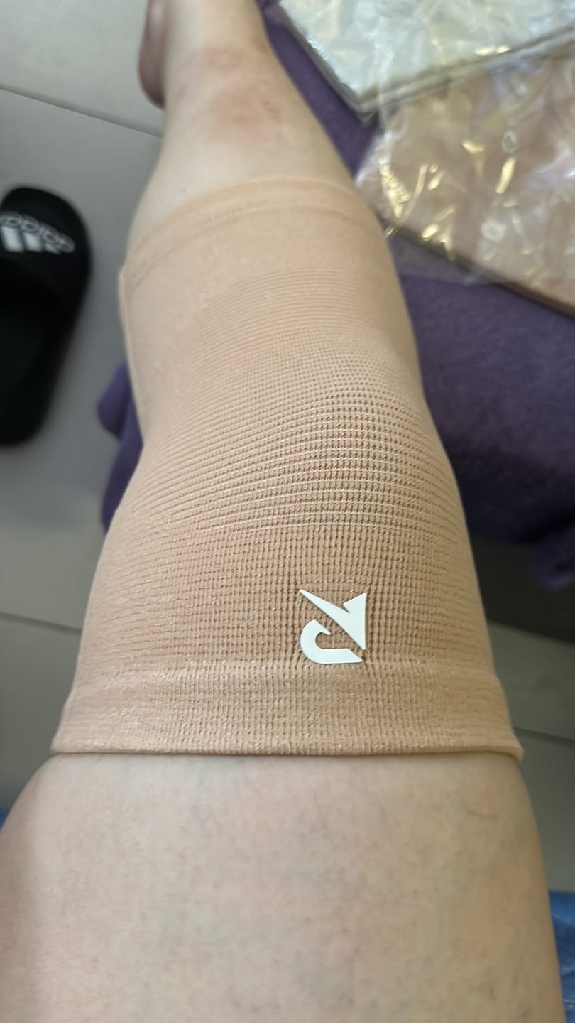 Customer photo review of Recovry™ V2 Kneesleeve