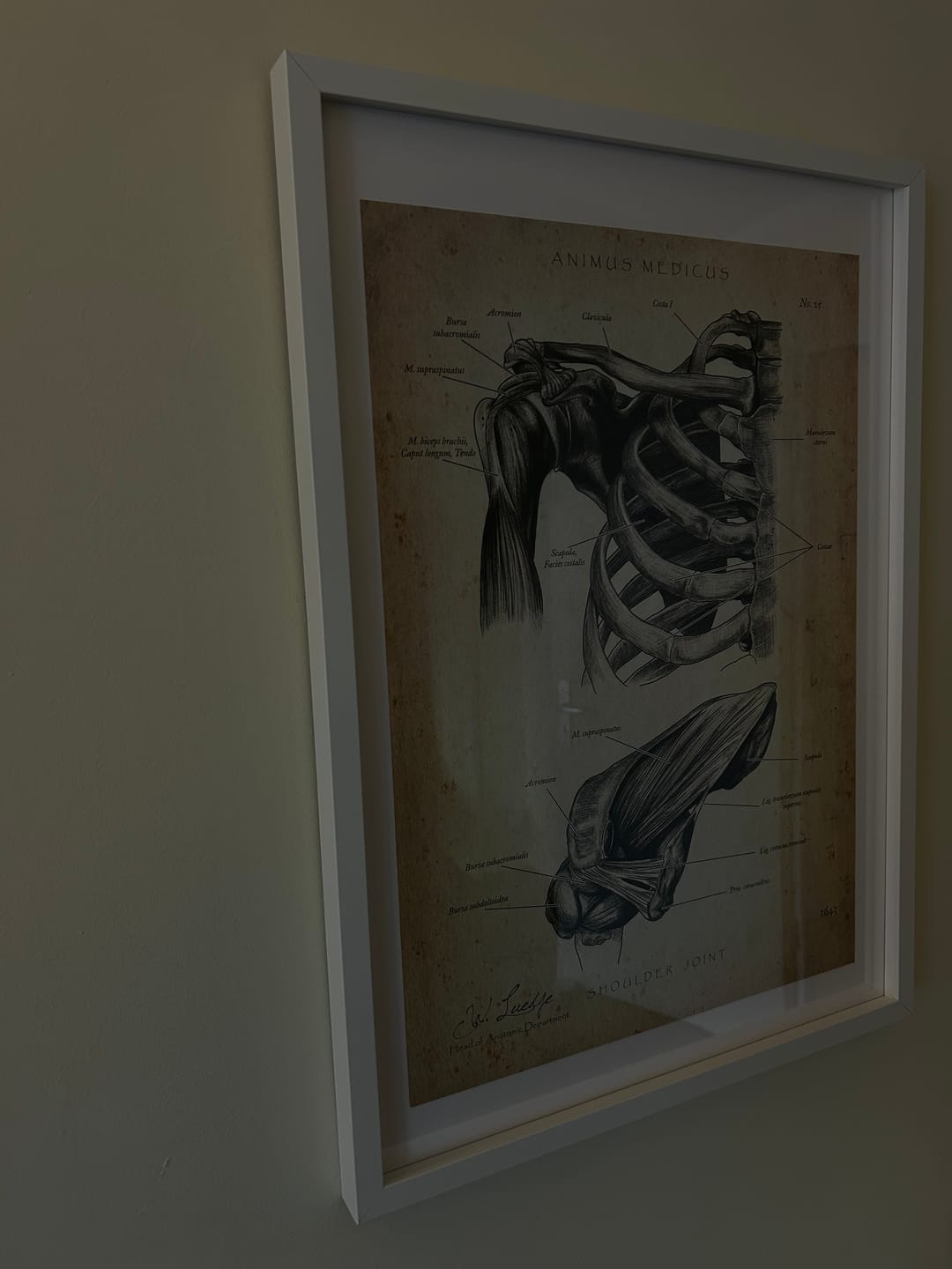 Customer photo review of Schultergelenk Anatomie