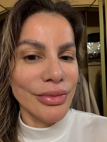 Customer photo review of Grass Fed Tallow & Honey Balm