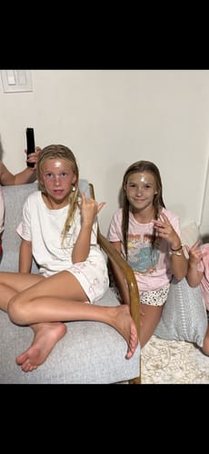 Customer photo review of After-Sun Hydrogel Facial Mask