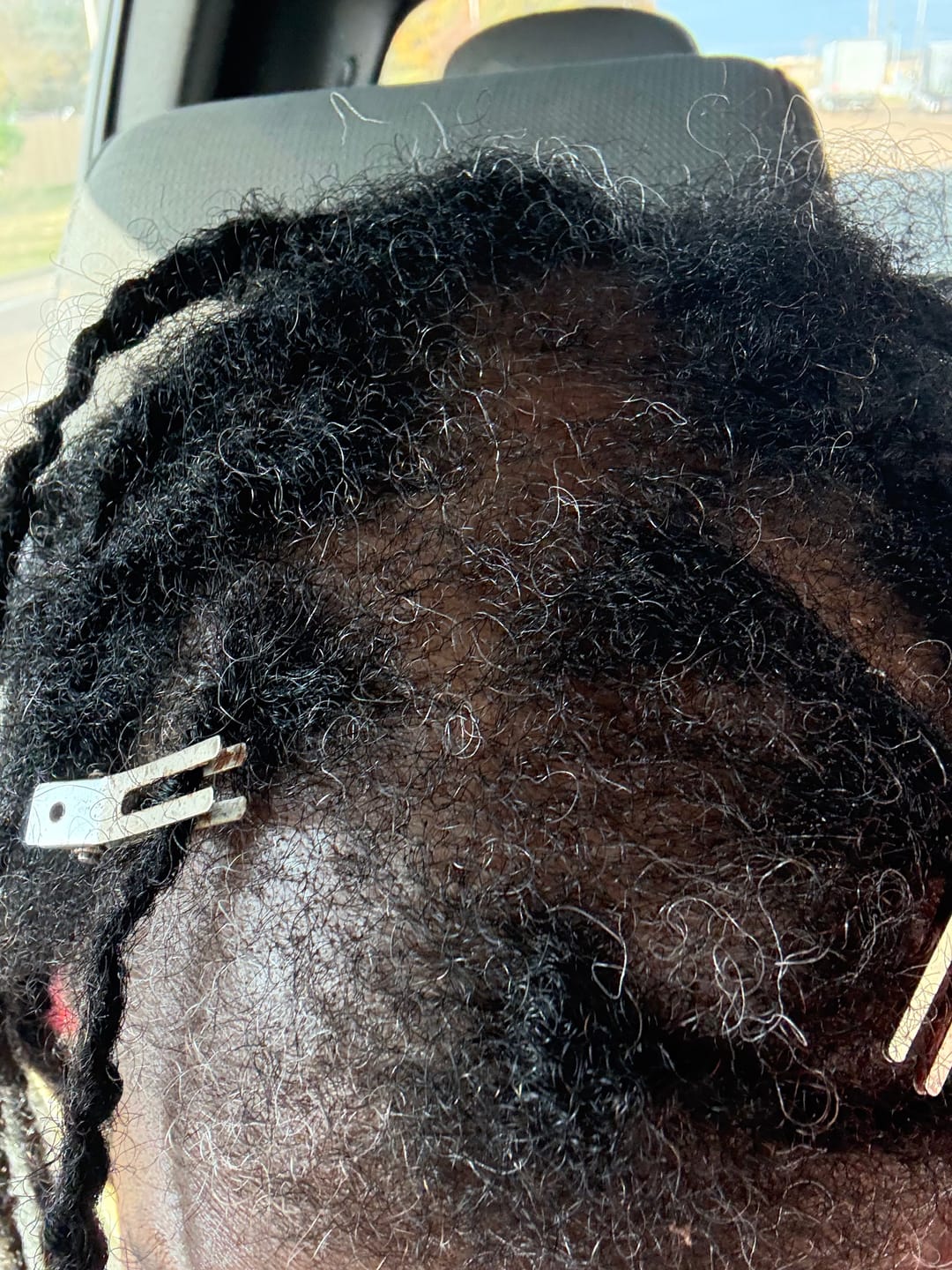 Customer photo review of Marula Luxe Hair Growth Serum 2 oz.