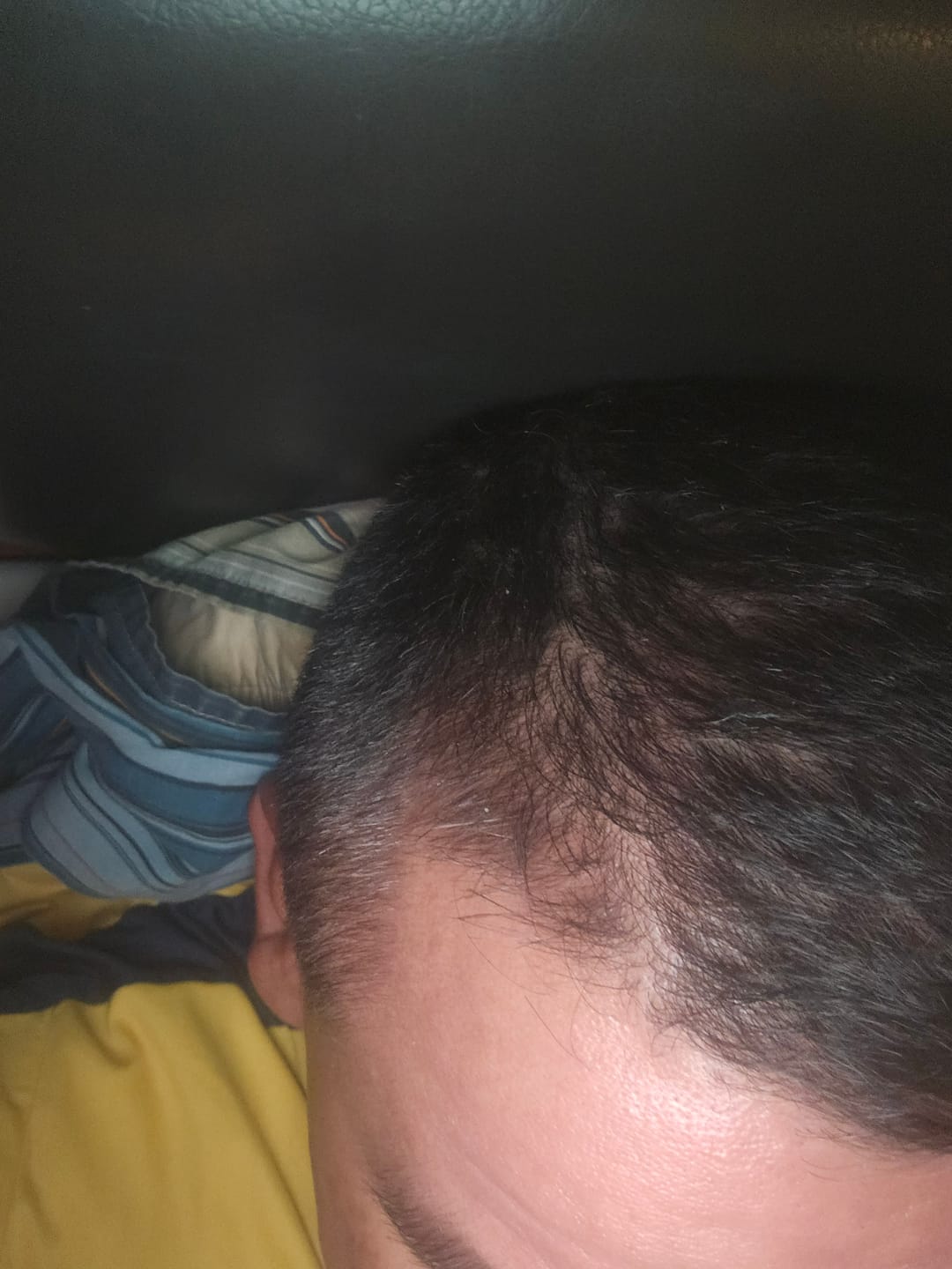 Customer photo review of Pack Anticaída de Cabello para 1 Mes