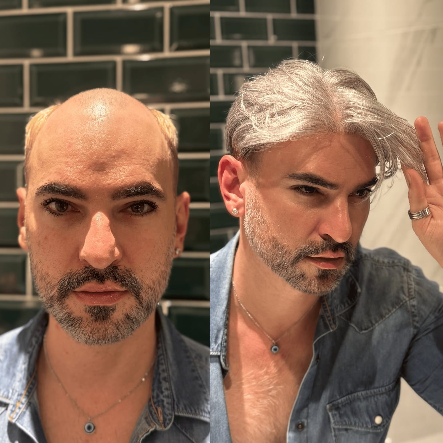 Customer photo review of 70% Extra Light Density Men Hair System V-loop 0.03mm skin base Sage|No-shine under Lights, Blends Well with Your Skin