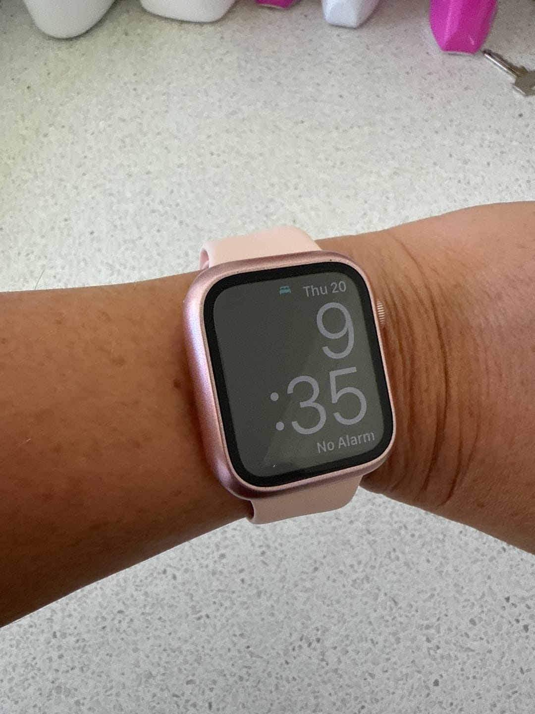 Customer photo review of All-in-one classic Apple Watch Protection Case