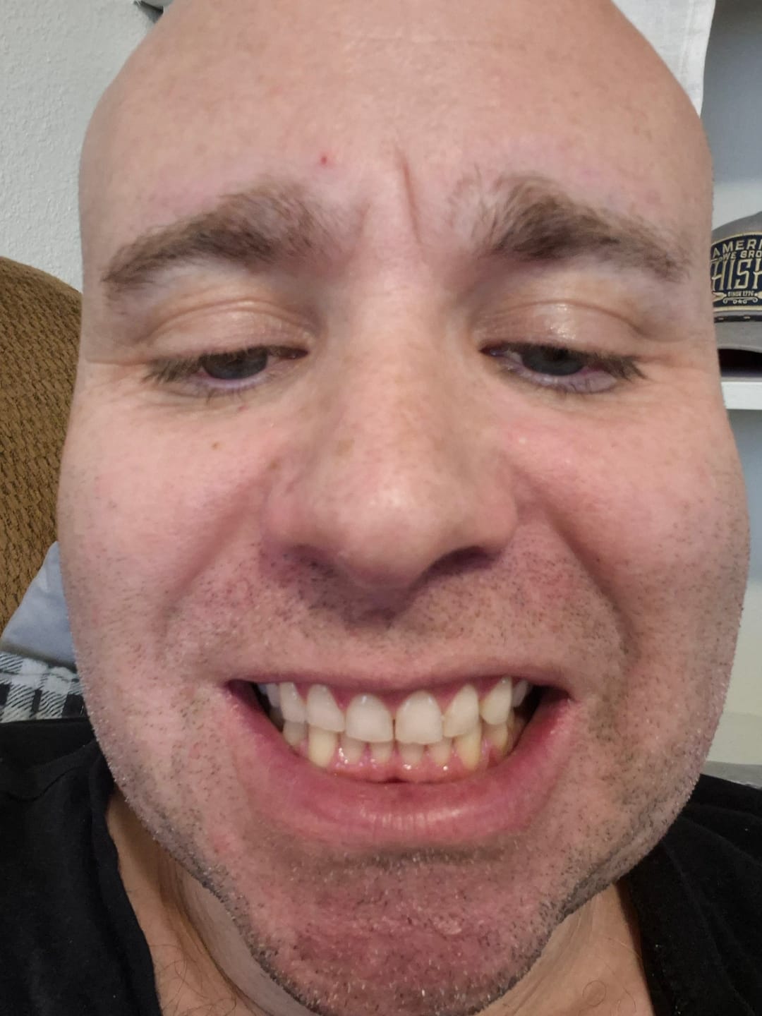Customer photo review of Novelix™ Pro Gold Whitening Pen