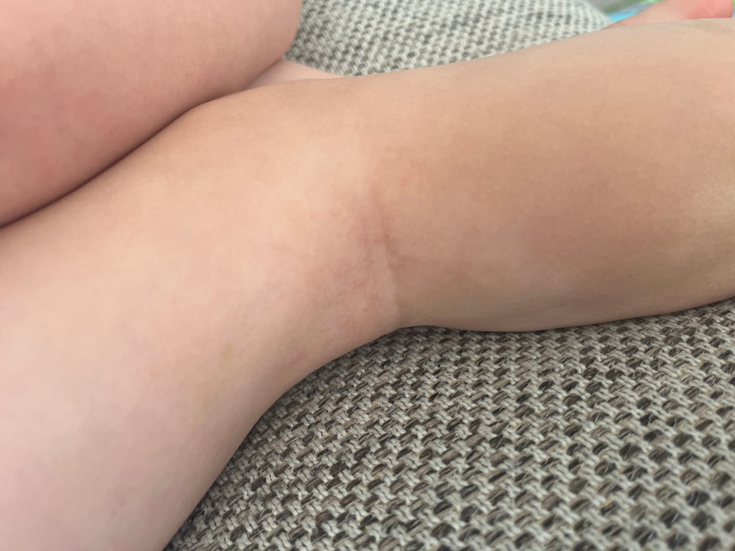 Customer photo review of Kawakawa Balm - Winner, Best SOS/Healing Balm 2024