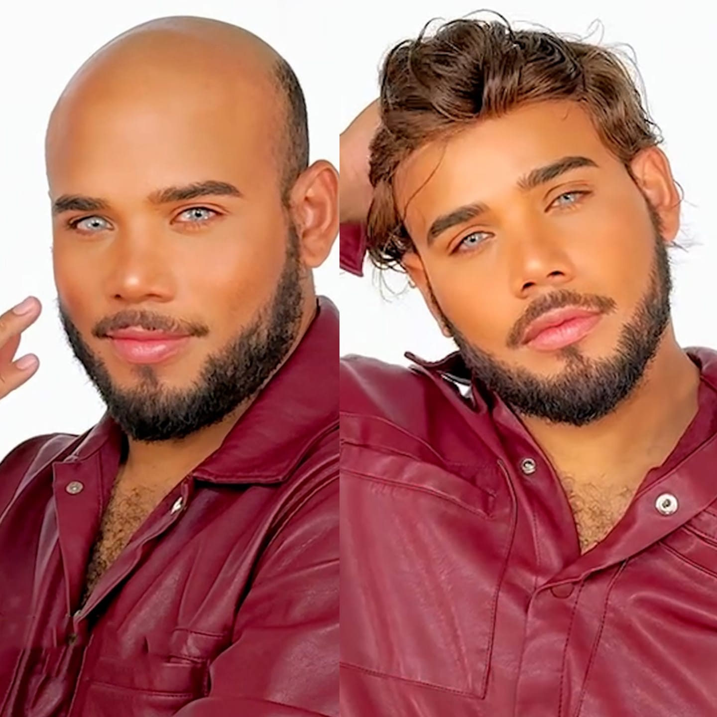 Customer photo review of 70% Ultra-light Density Ace Full french lace Men hair system