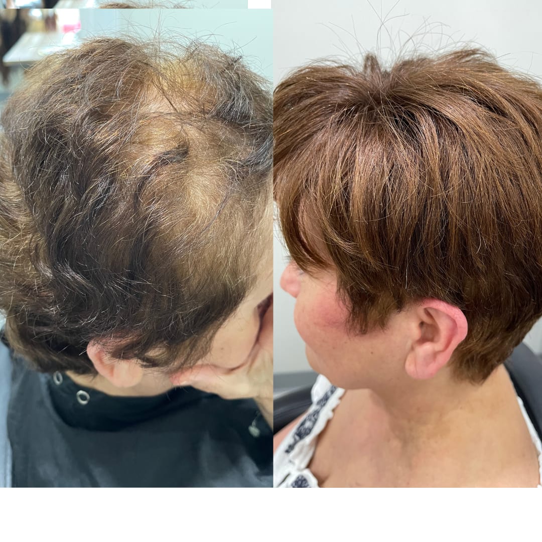 Customer photo review of High-Quality Short Hair Topper For Women With Thinning Hair