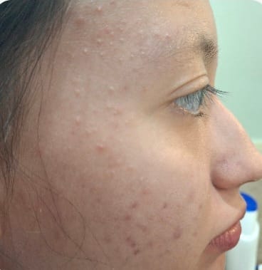 Customer photo review of Fórmulas Rx