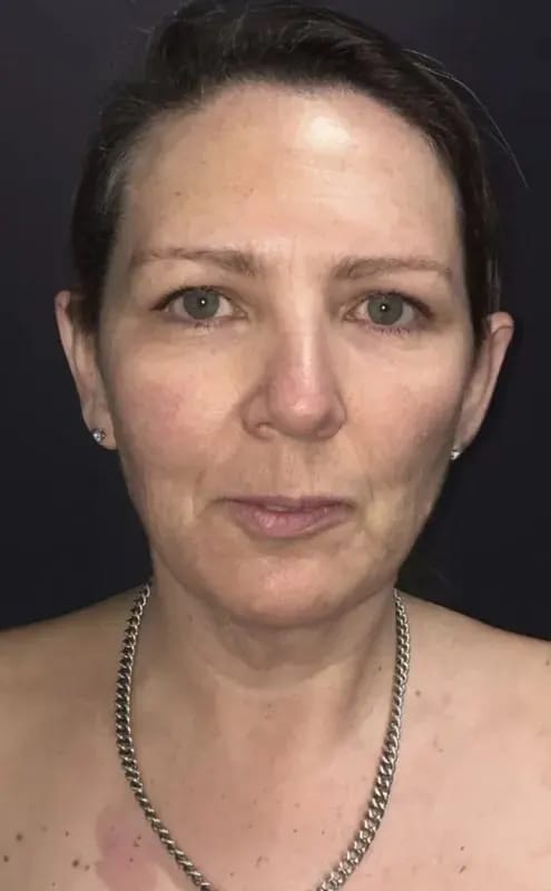 Customer photo review of NEUTRE® Collagène Marin Premium