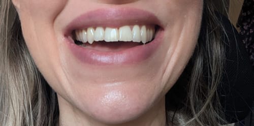 Customer photo review of Original Mint Toothpaste