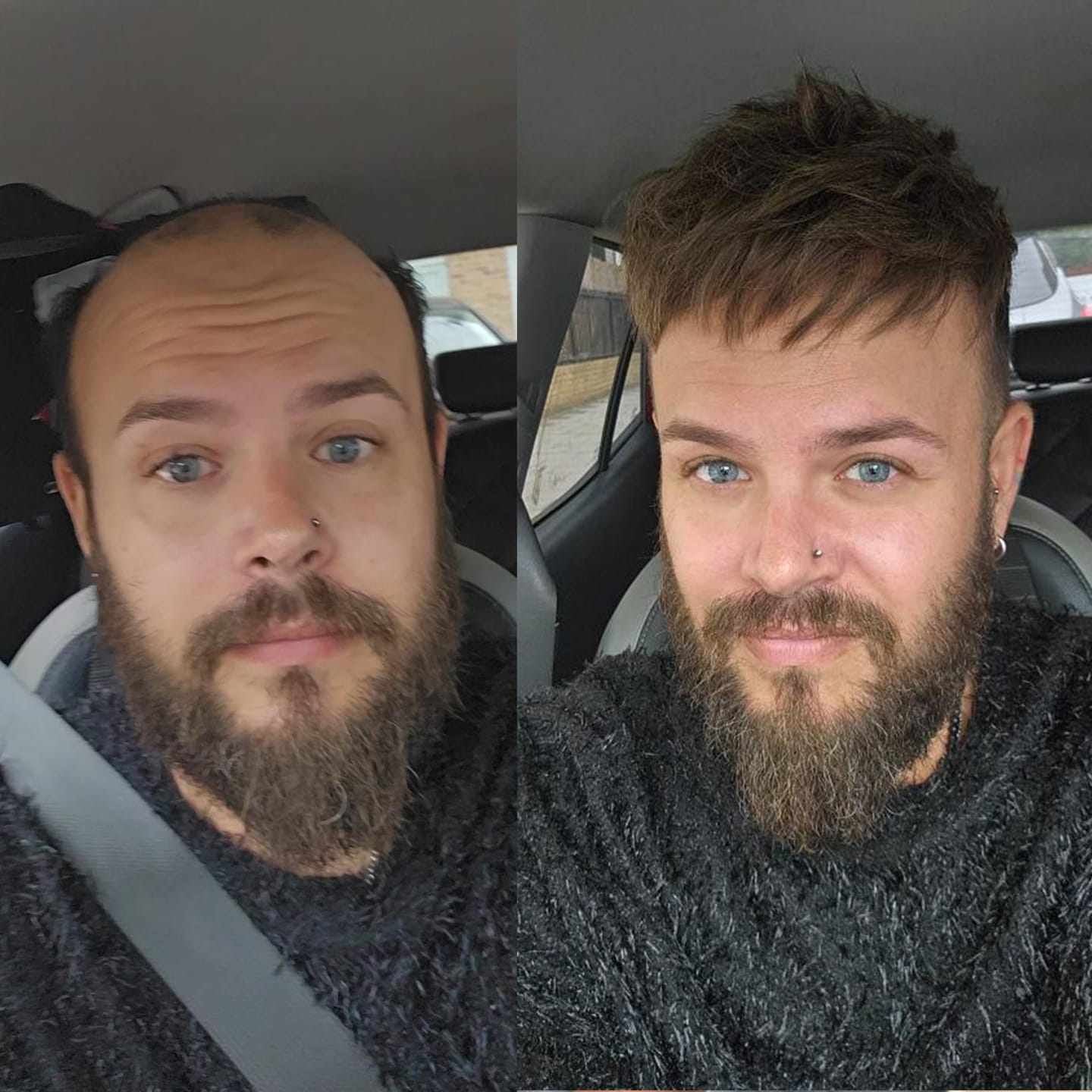 Customer photo review of 70% Ultra-light Density Ace Full french lace Men hair system