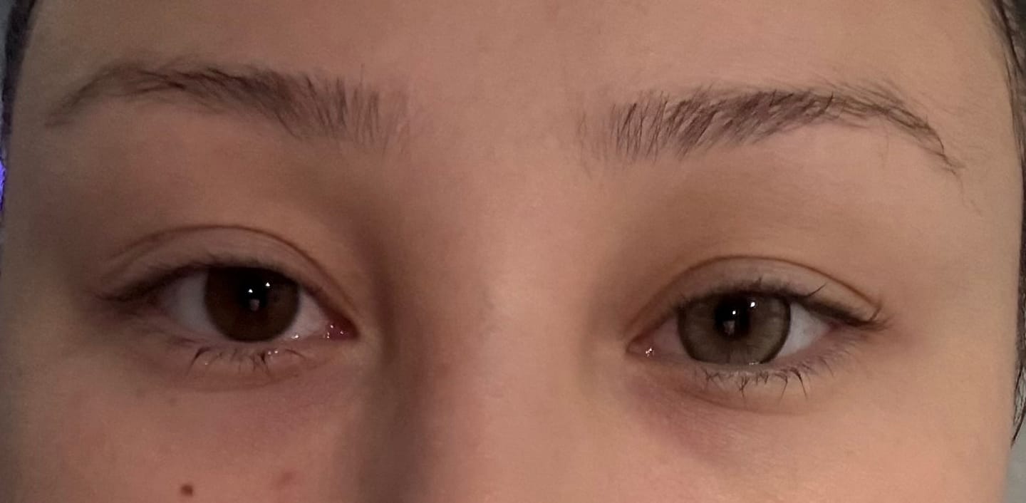 Customer photo review of Sleepizomb x Eyemoody Volcano Brown | 6 Months, 2 pcs