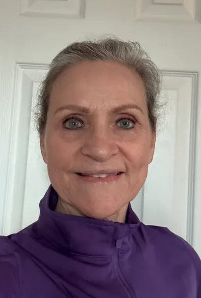 Customer photo review of Vivée Migraine Relief Mask