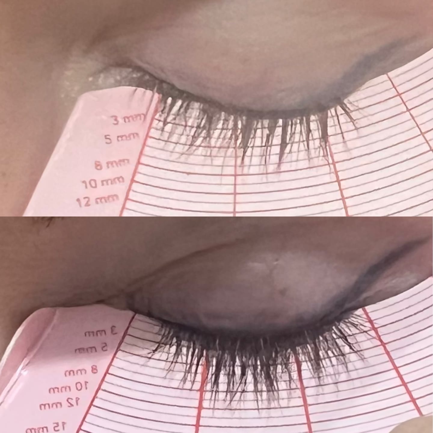 Customer photo review of Lash Rehab Eyelash Growth Serum – Clinically Proven (3ml)