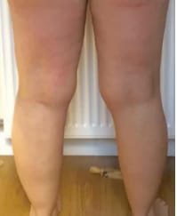 Customer photo review of CelluLuxe Pro - Straffe deinen Körper in nur 10 Minuten täglich ganz bequem von zu Hause.