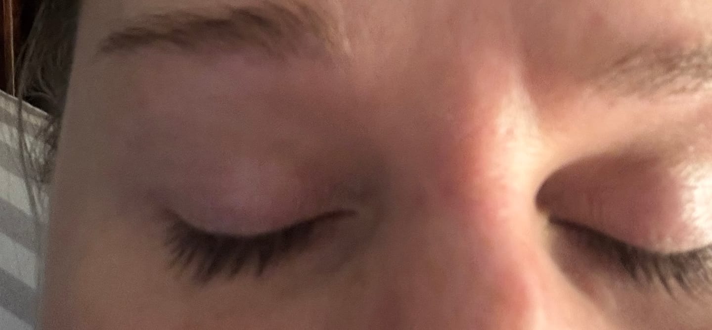 Customer photo review of Enhance® - Eyelash Growth Serum