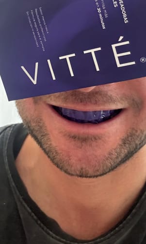 Customer photo review of Tiras Blanqueadoras VITTÉ Pack 42 días