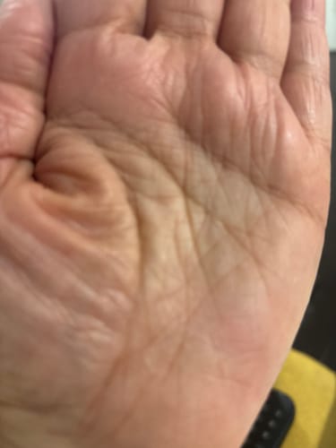 Customer photo review of Calm Balm