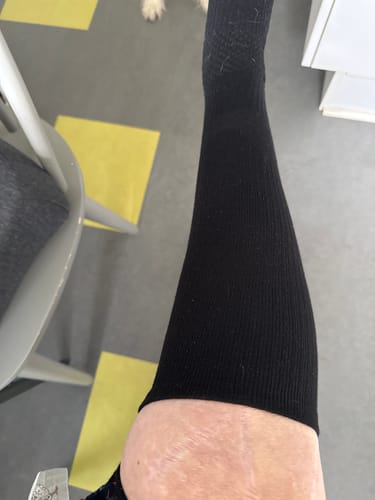 Customer photo review of Støttestrømper