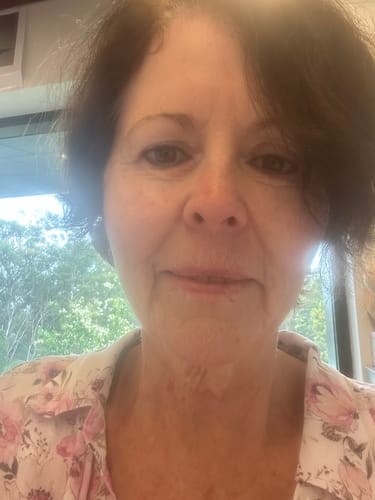 Customer photo review of Sea Cucumber Collagen Day & Night Pack