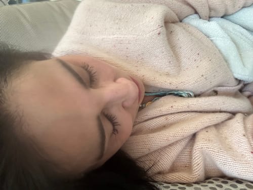 Customer photo review of iGlow Lash Maximizer - Lash Serum, 3 ml