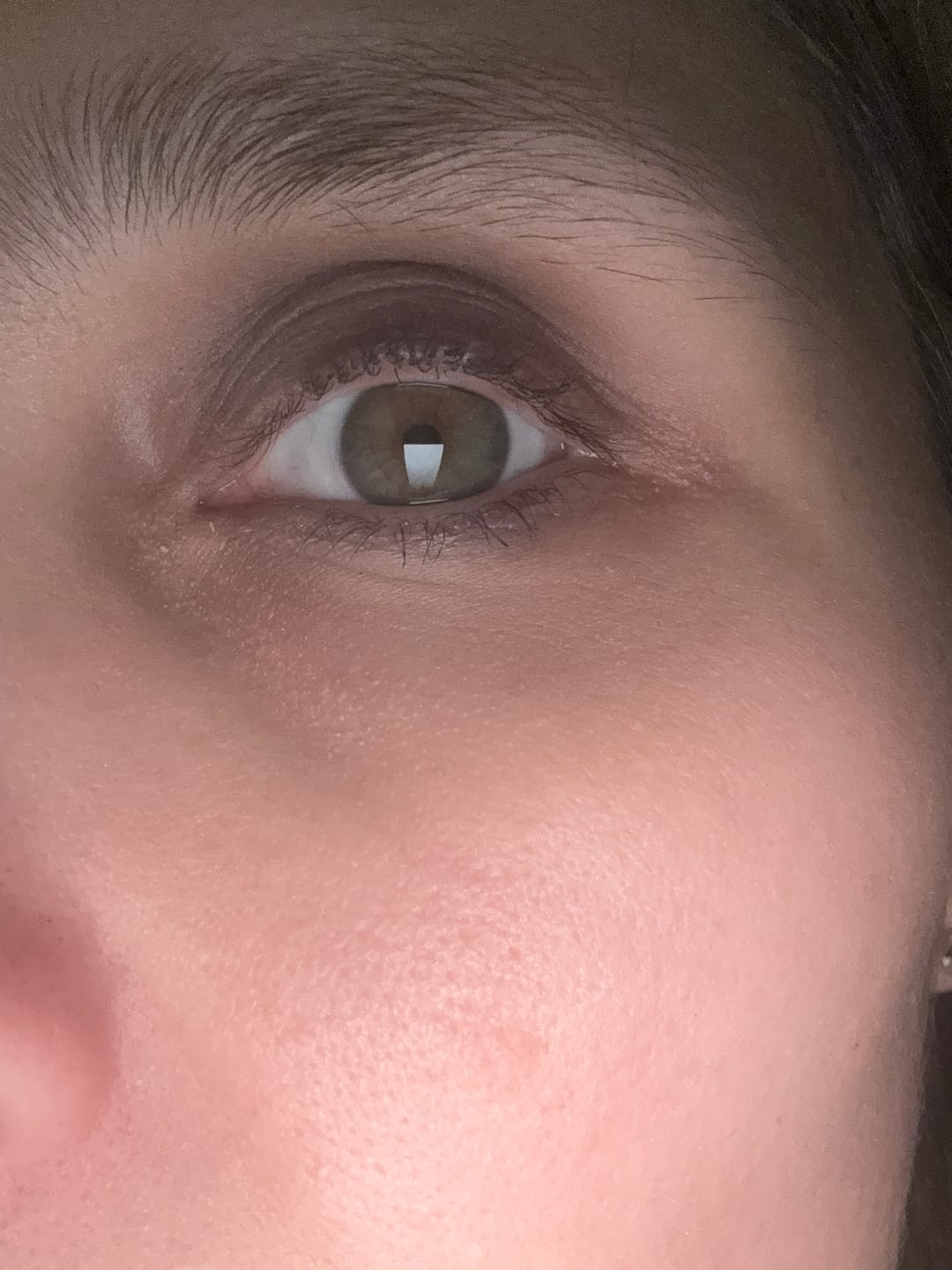 Customer photo review of Hyper Potent Dark Circles & Bag Eye Balm