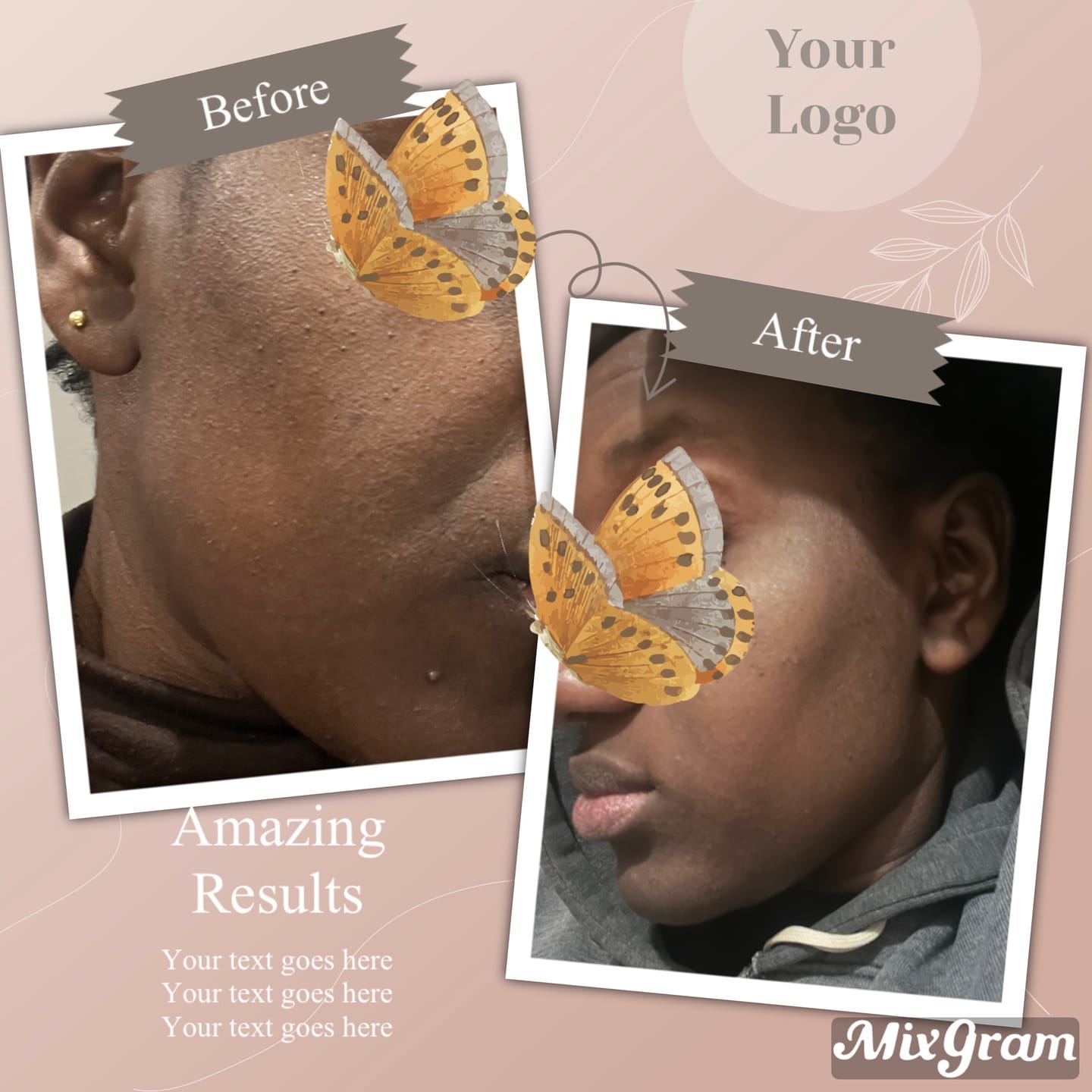 Customer photo review of Routine Anti-Imperfections 4 en 1