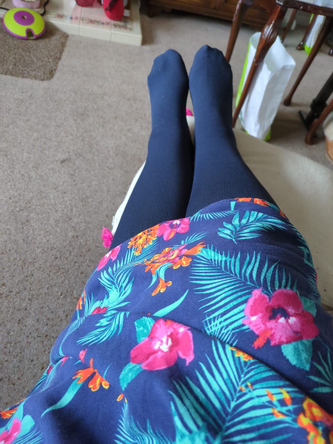 Customer photo review of Everstride™ Advanced Wide Compression Socks For Pain Relief