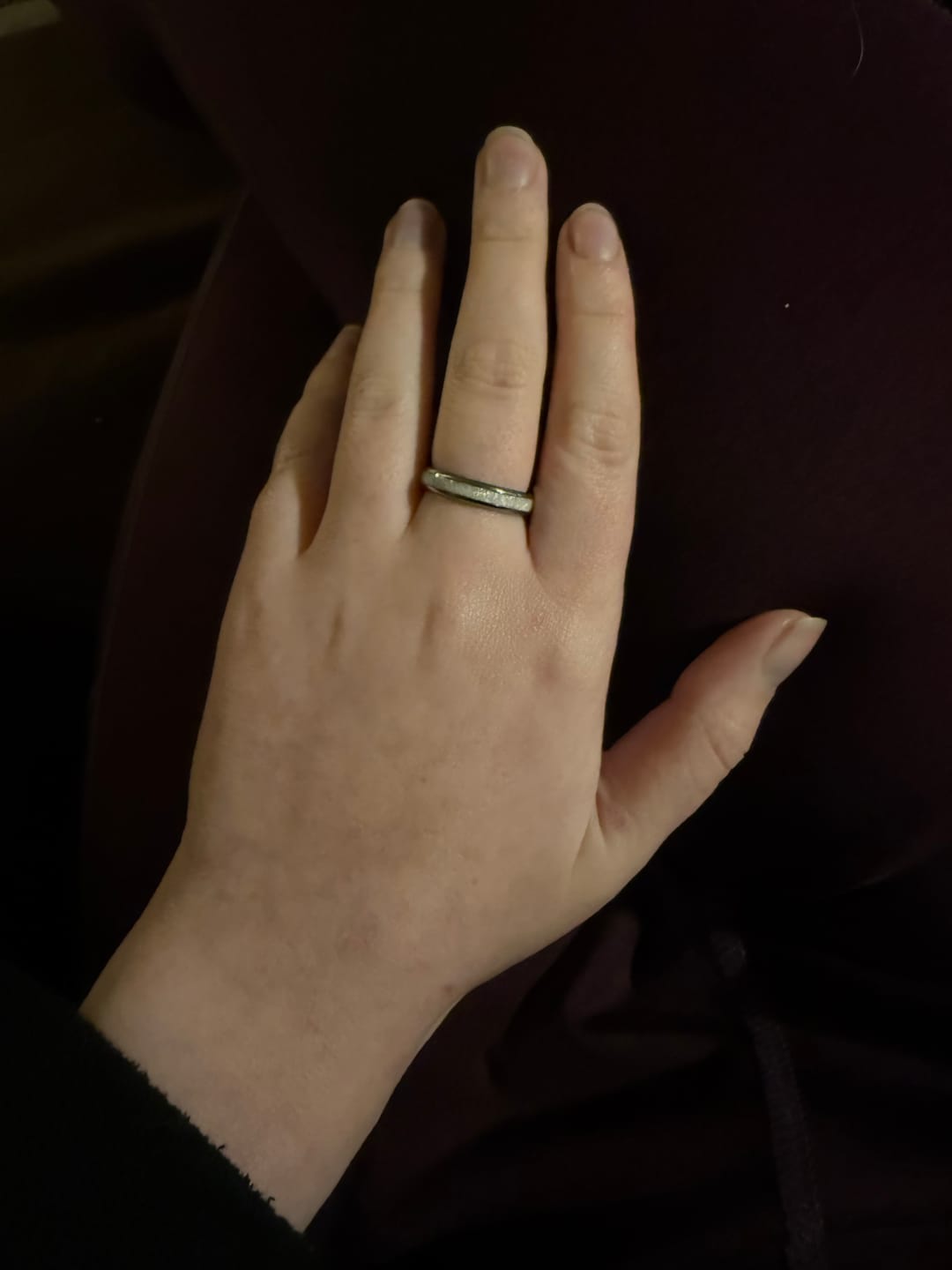 Customer photo review of The Original White Opal 4mm Wonder Ring