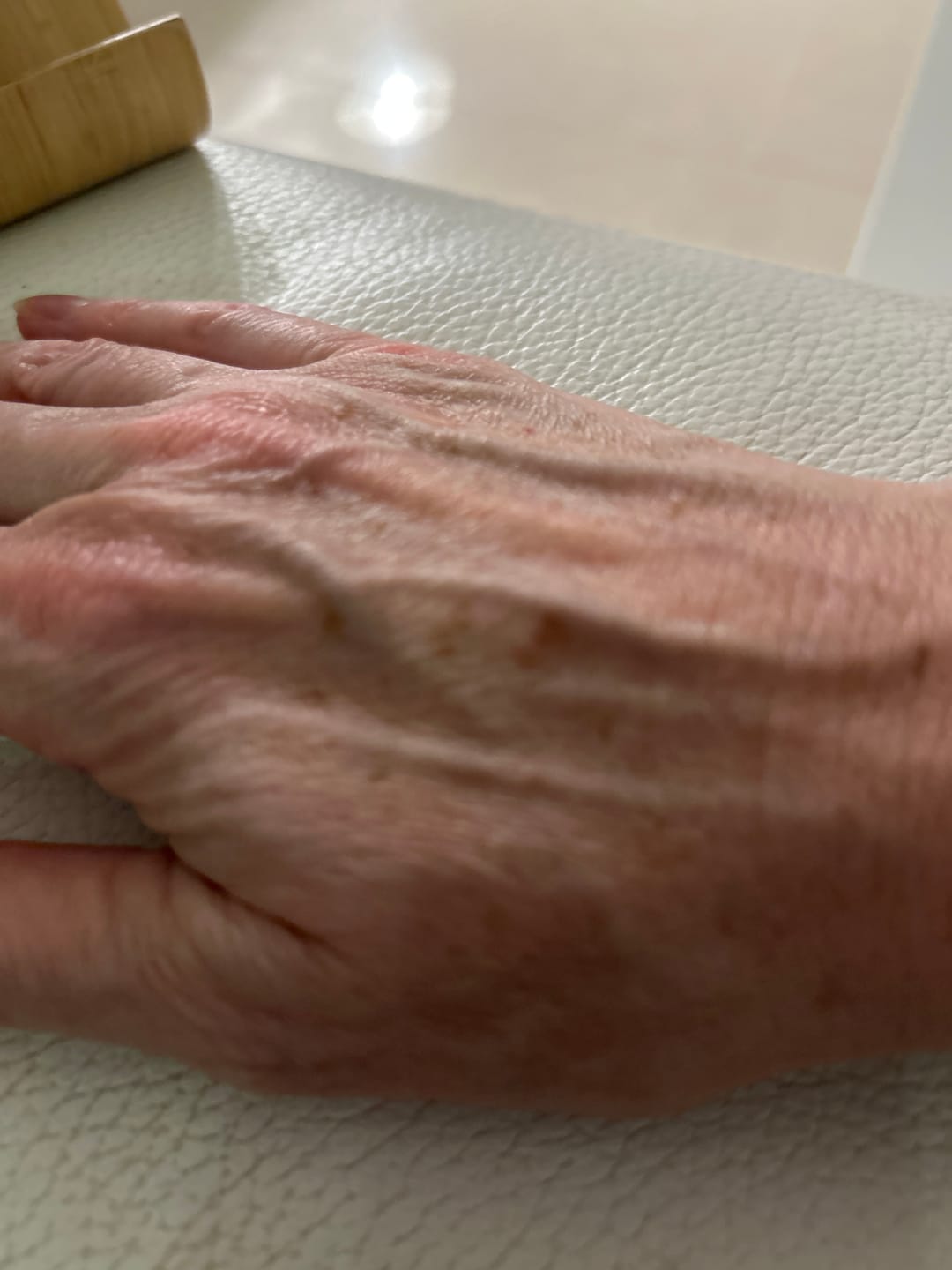 Customer photo review of Bioskin Duo Pack