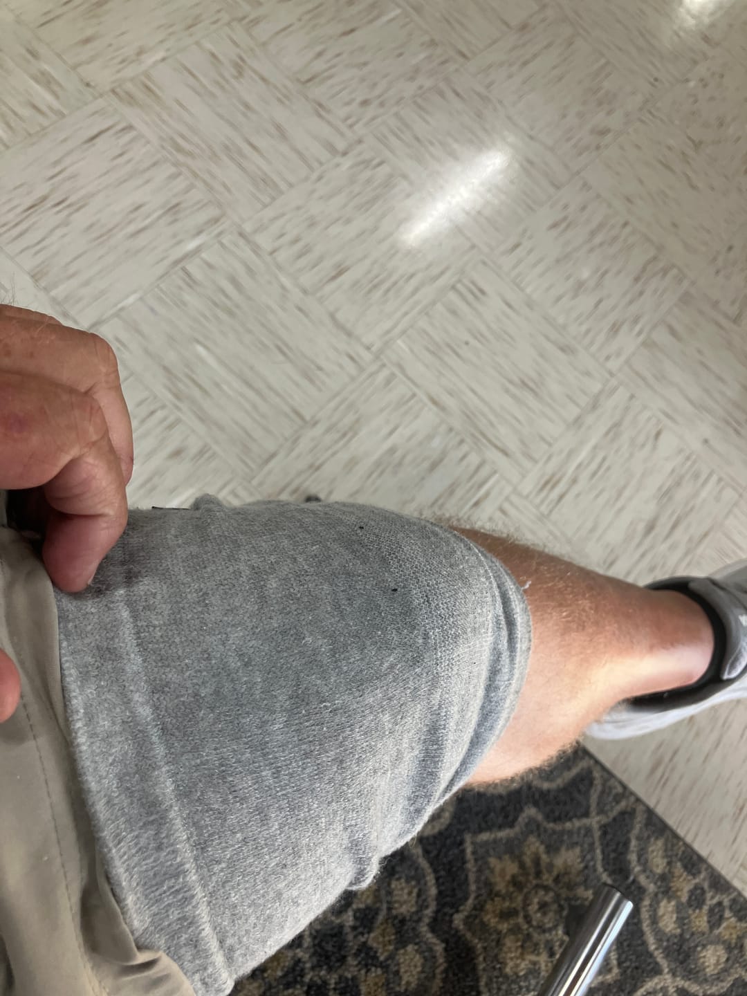 Customer photo review of VitalCompress – Premium Bambus-Kniebandage