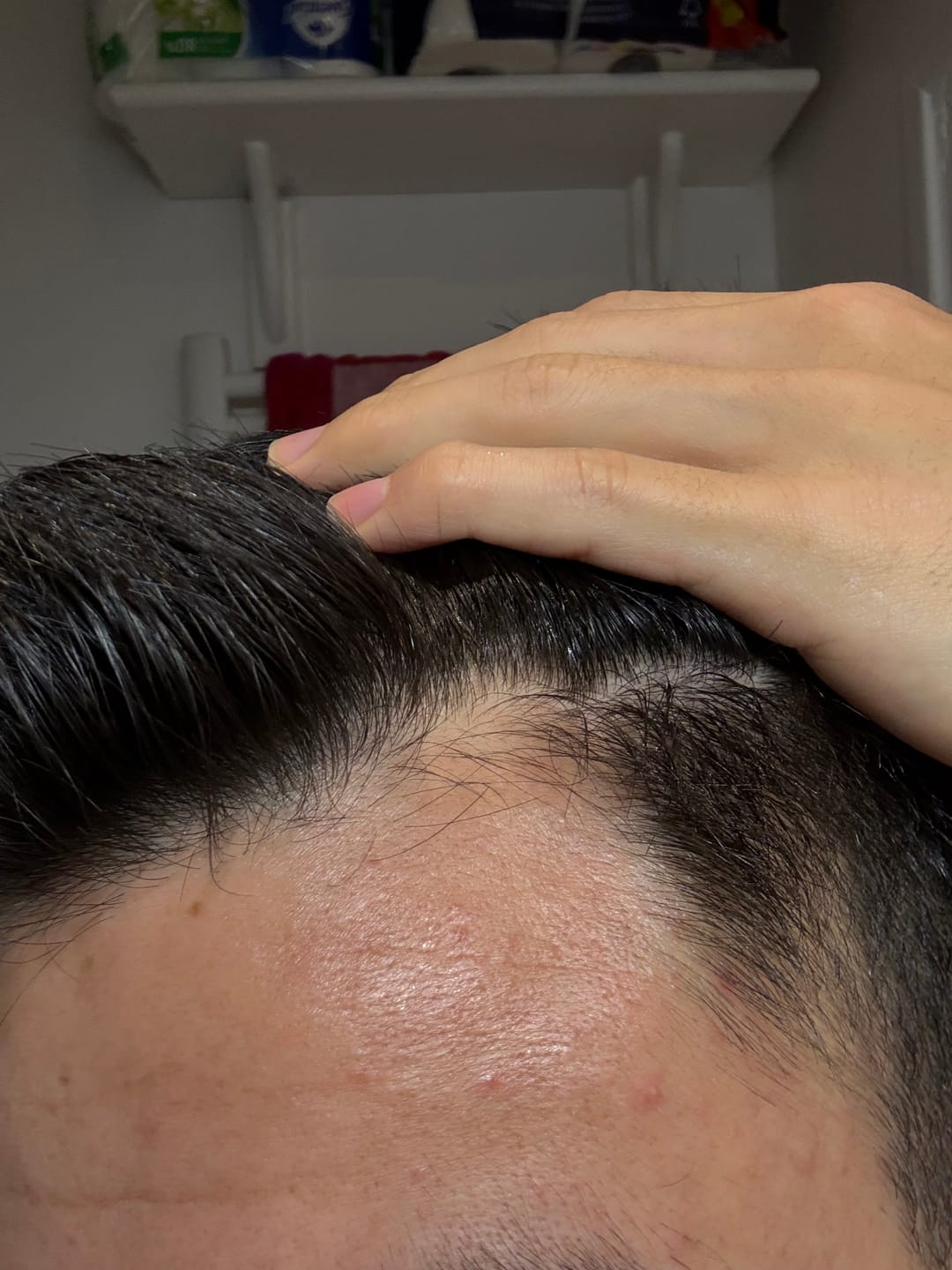 Customer photo review of SÉRUM CAPILLAIRE MULTI ACTIF BIO-DENSYL®